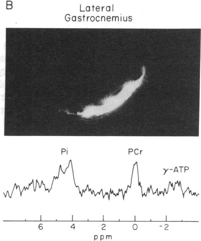 graphic file with name pnas01063-0248-a.jpg