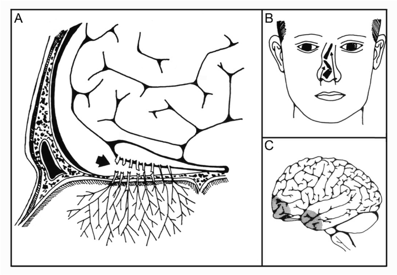 Fig. 1