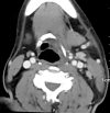 Fig. 3
