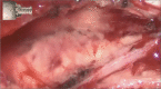 Figure 5: