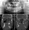Fig. 1
