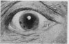 261