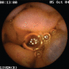 Figure 4)