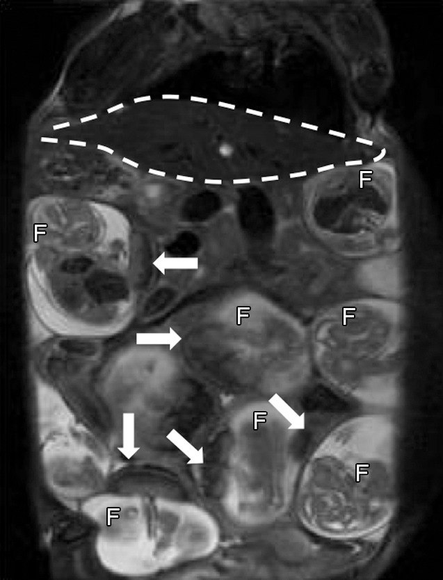 Figure 1a: