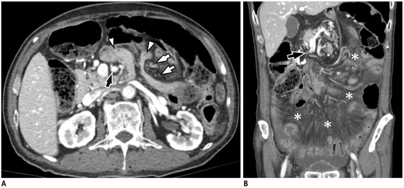 Fig. 15