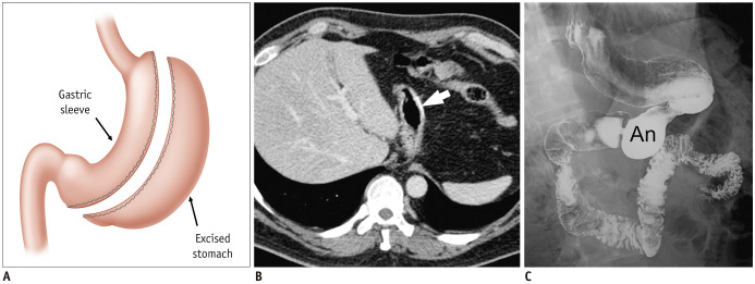 Fig. 18