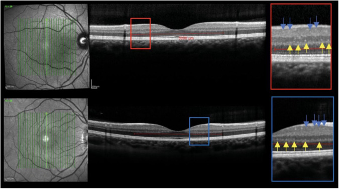 Fig. 3