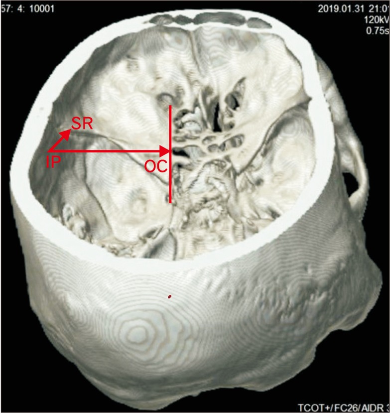 Fig. 6