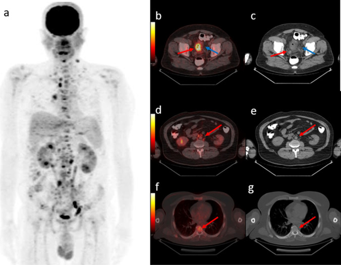 Fig. 4