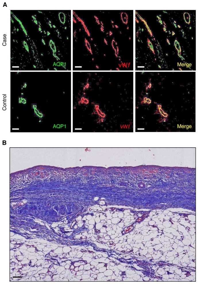 Figure 1 —