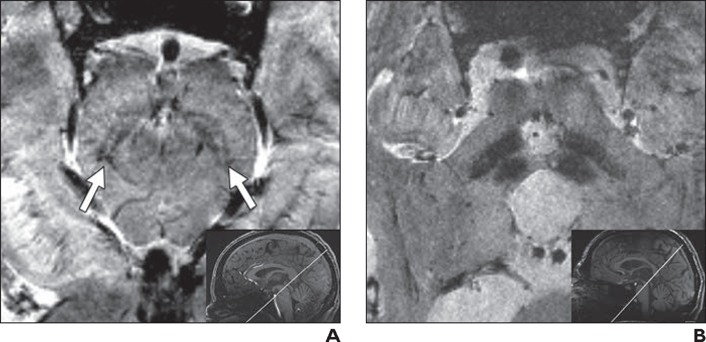 Fig. 5—