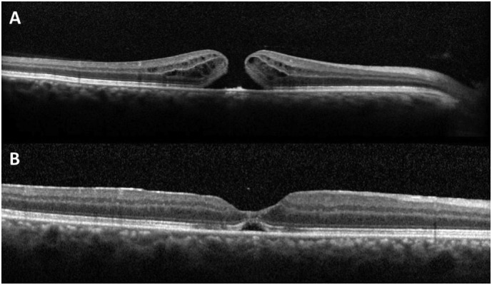 Fig. 3