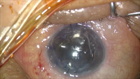 Fig. 2 E