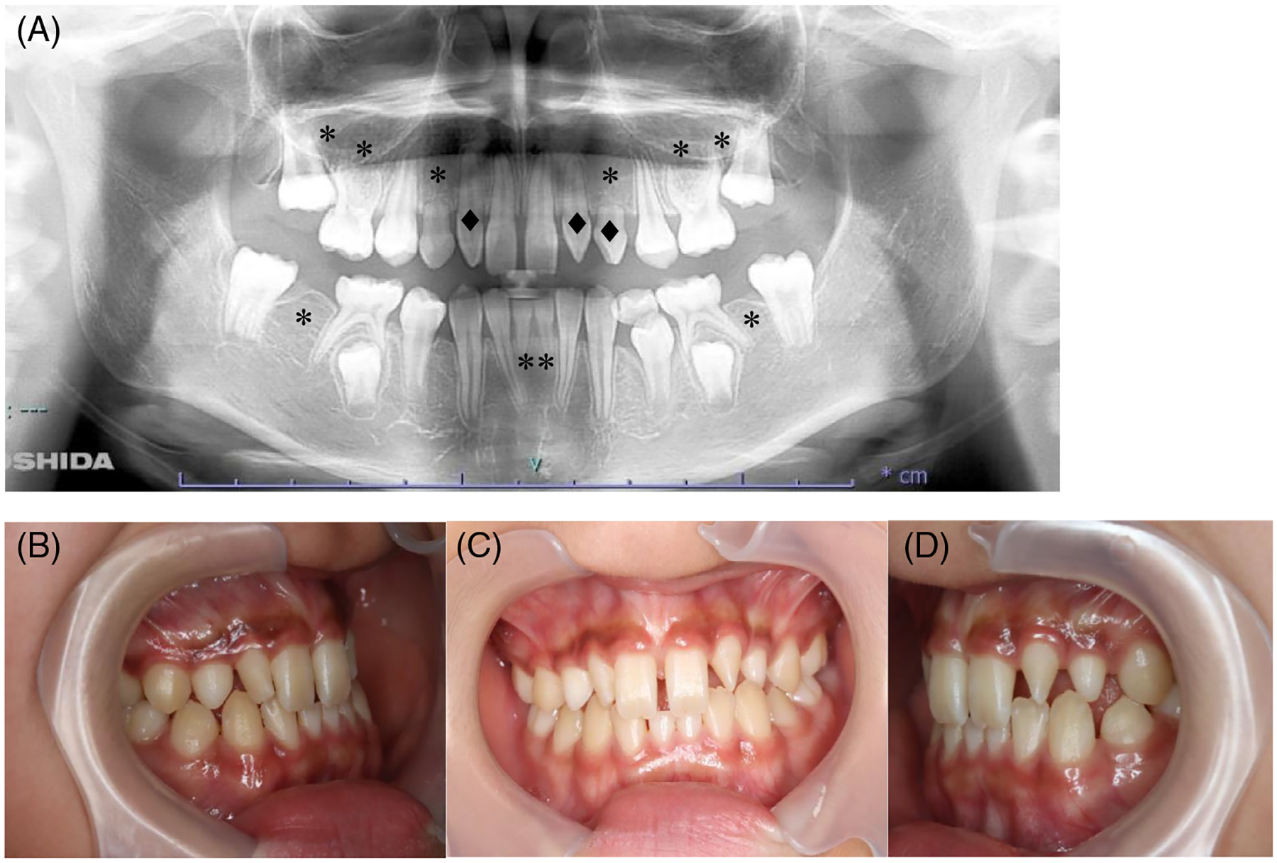 FIGURE 2