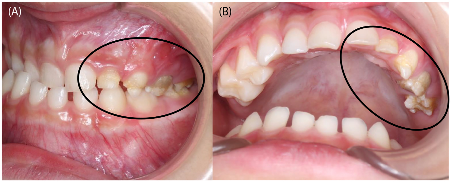 FIGURE 3