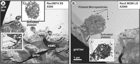 Fig. 11