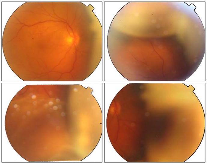 Fig. 2