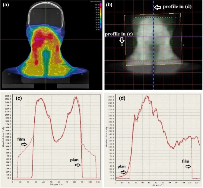 Fig. 12