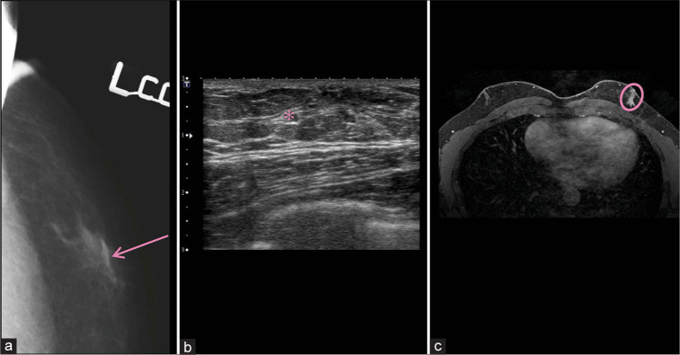 Figure 11: