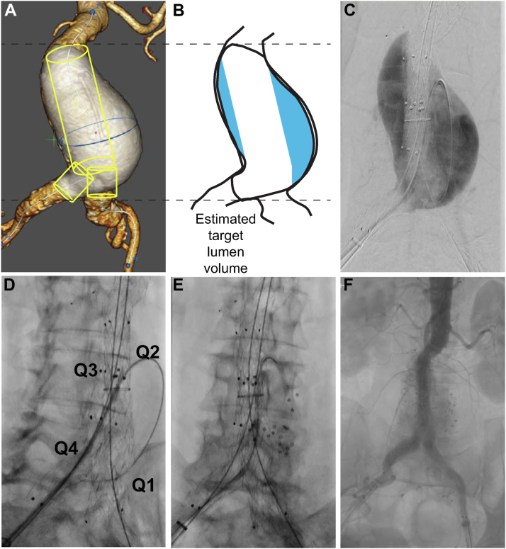 Fig 2