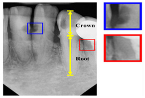 graphic file with name diagnostics-14-02442-i003.jpg