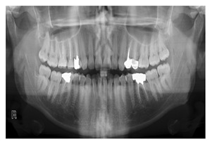 graphic file with name diagnostics-14-02442-i007.jpg