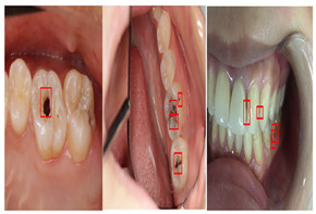 graphic file with name diagnostics-14-02442-i008.jpg