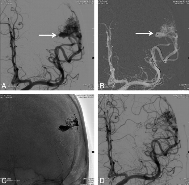 Fig 4.