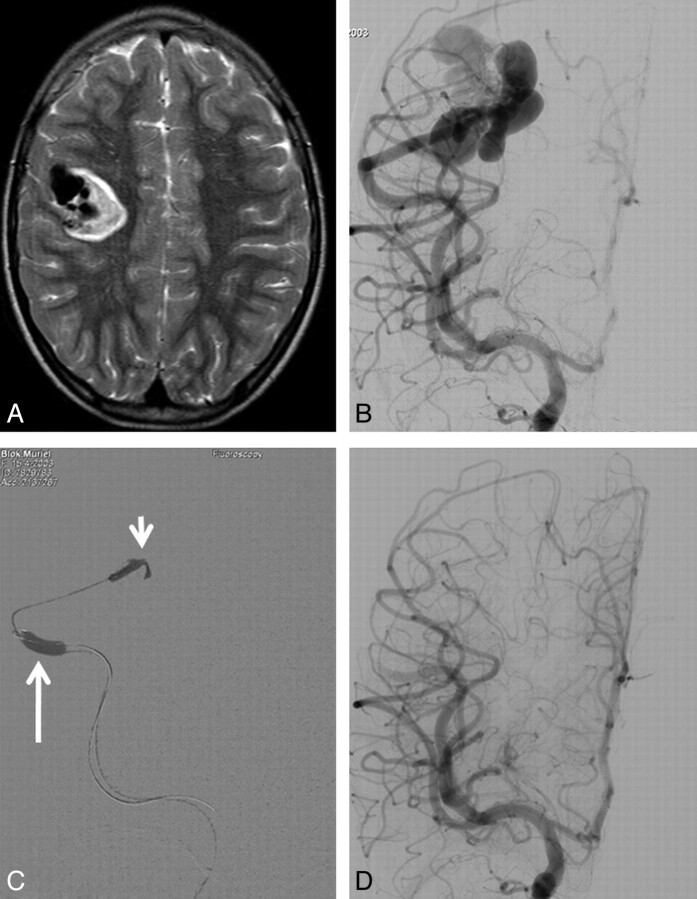 Fig 2.