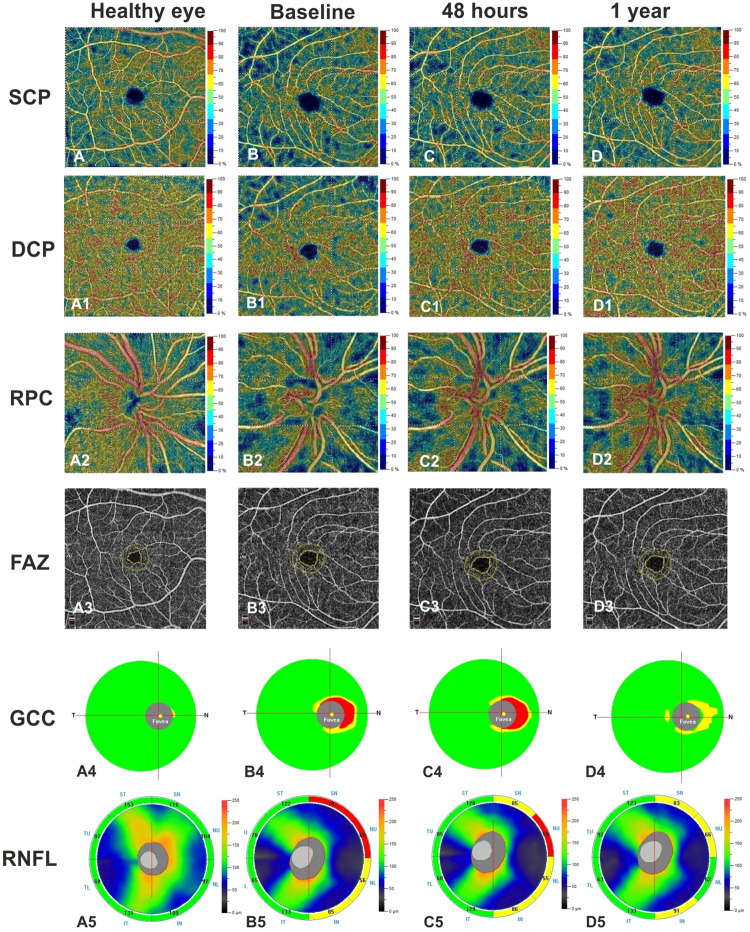 Fig 2