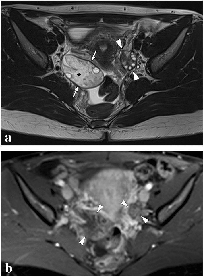 Fig. 35