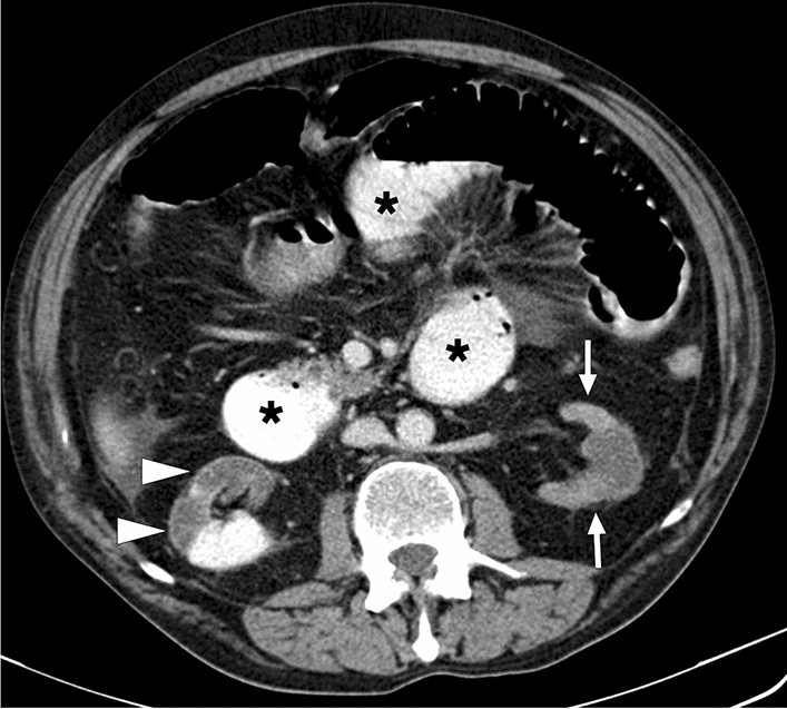 Fig. 38