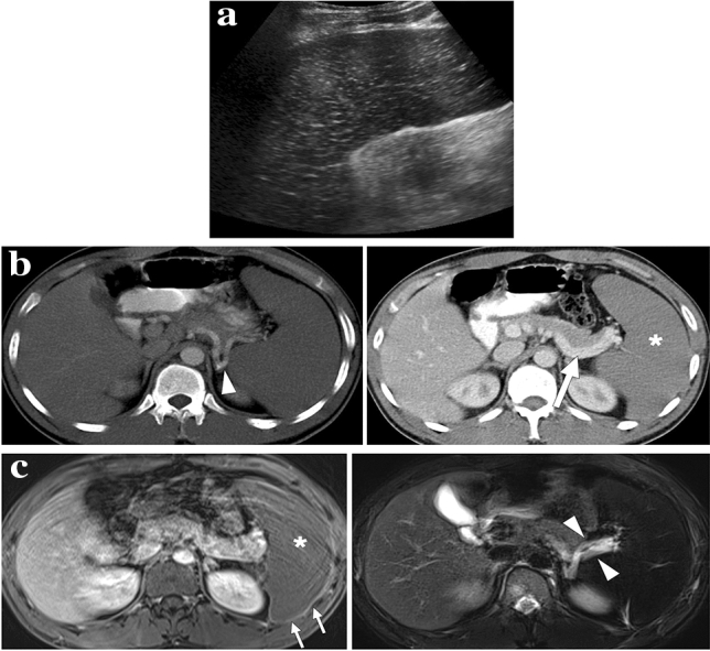 Fig. 22