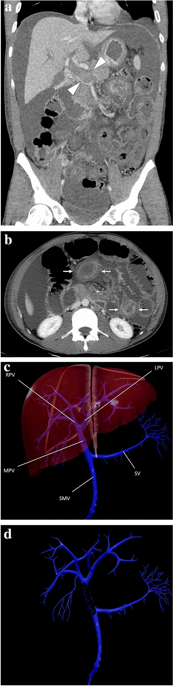 Fig. 12