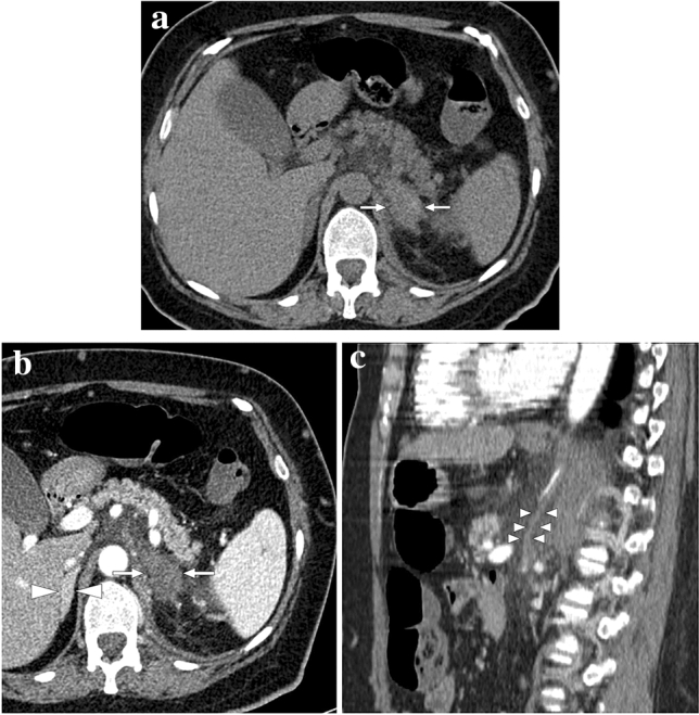 Fig. 26