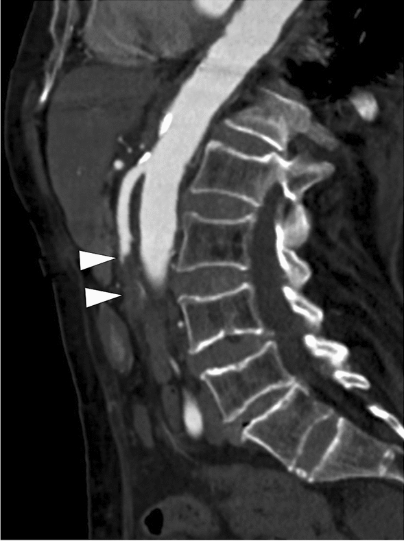 Fig. 10