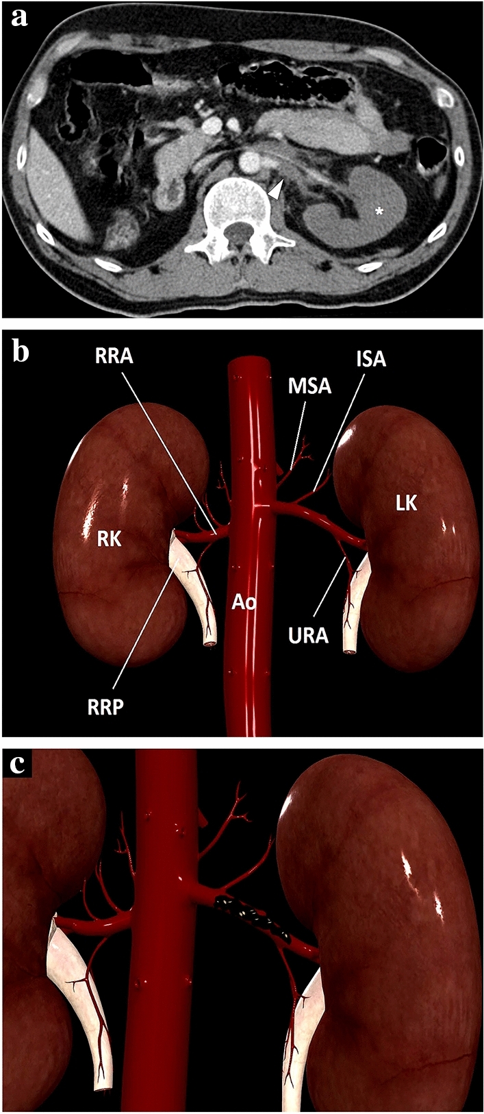 Fig. 15