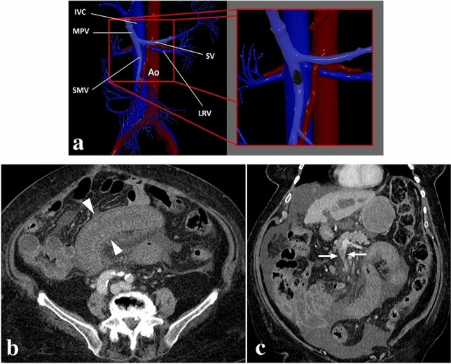 Fig. 13