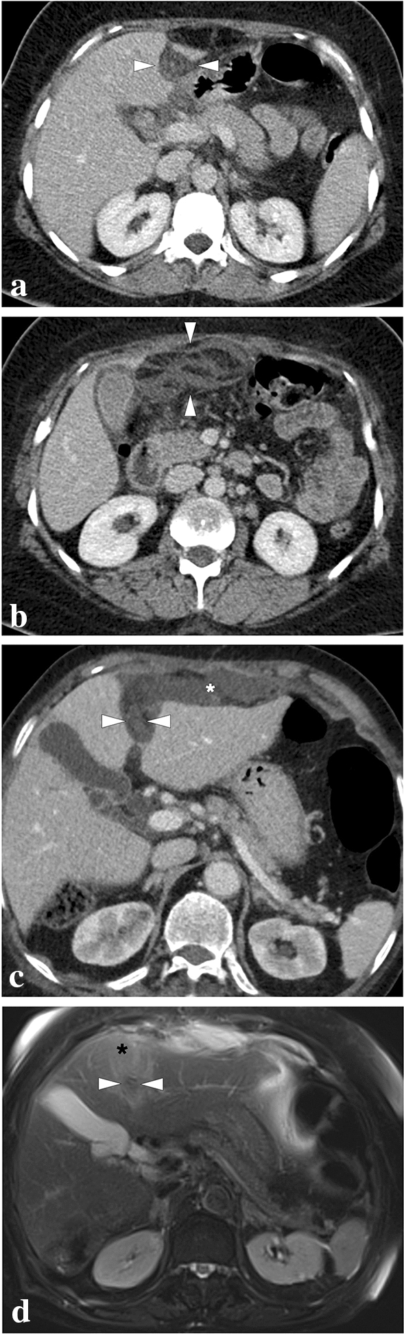 Fig. 32