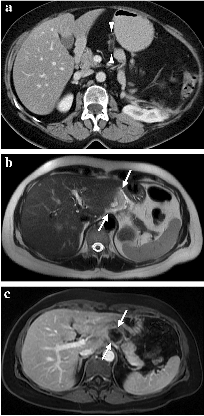 Fig. 33