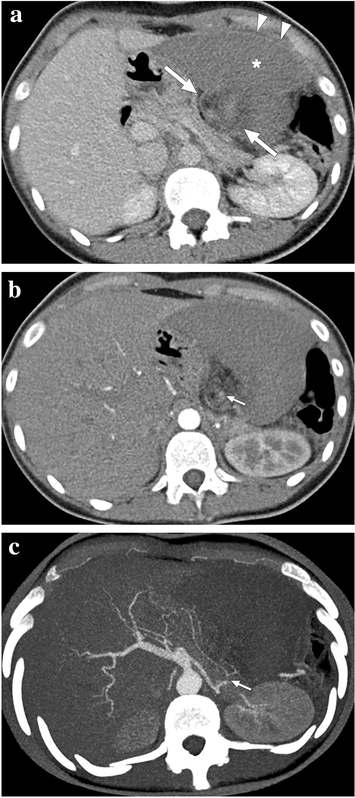 Fig. 19