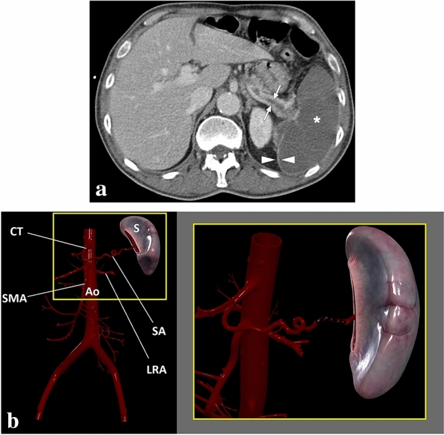 Fig. 21