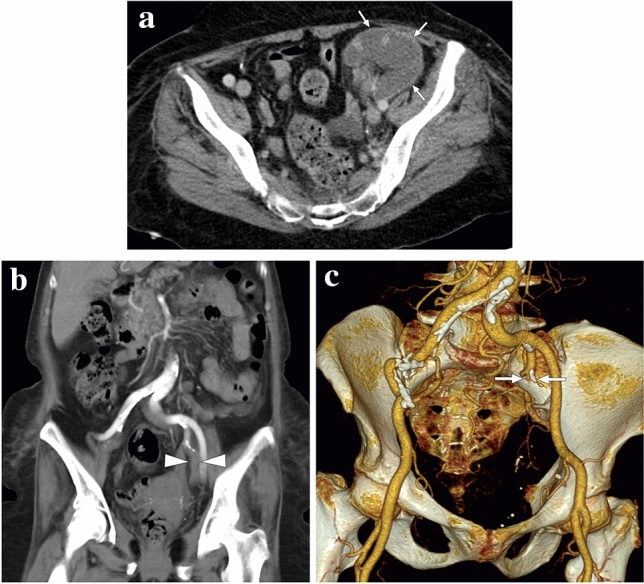 Fig. 17