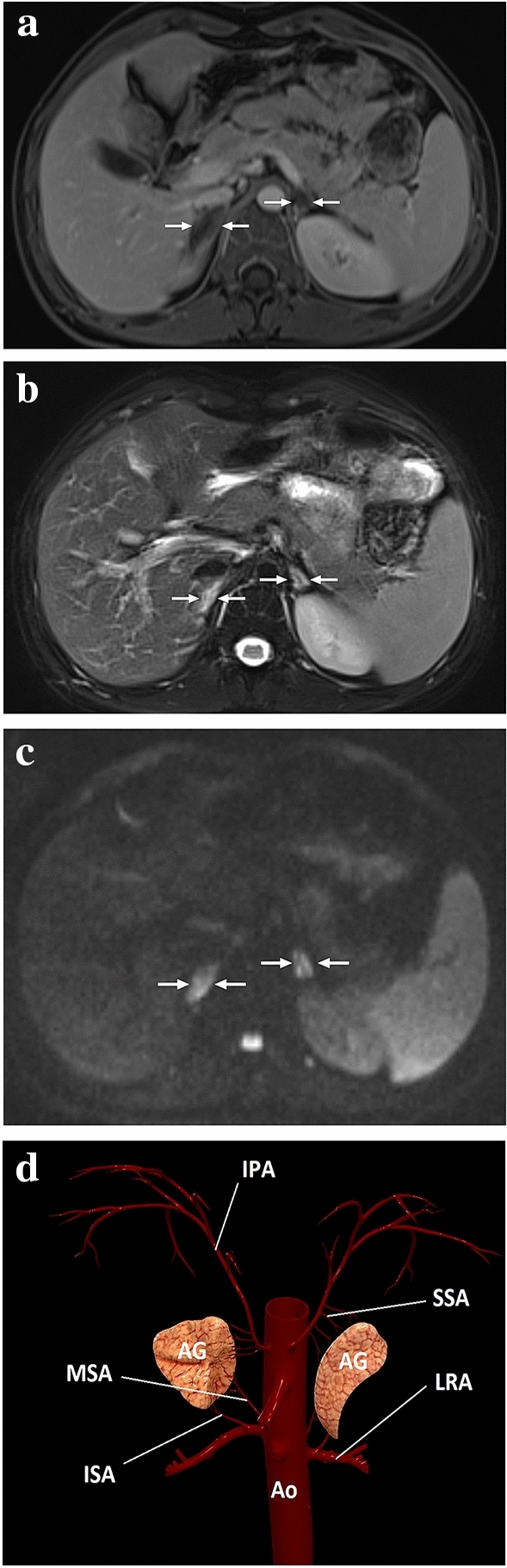 Fig. 25