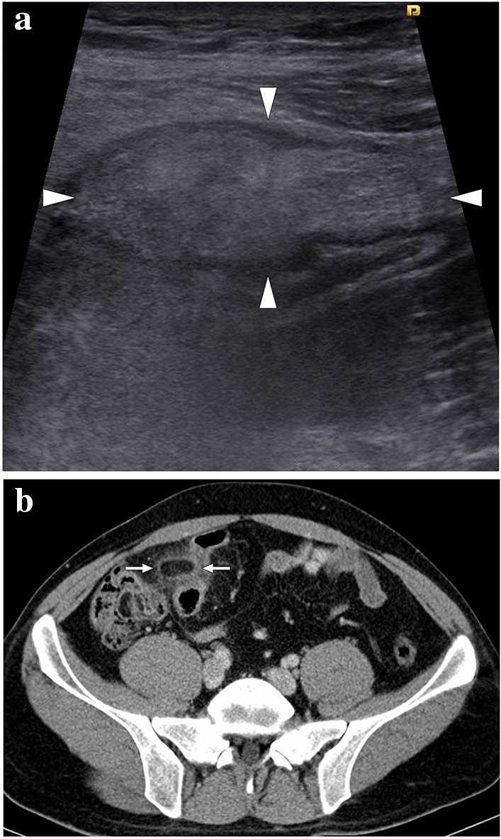 Fig. 30