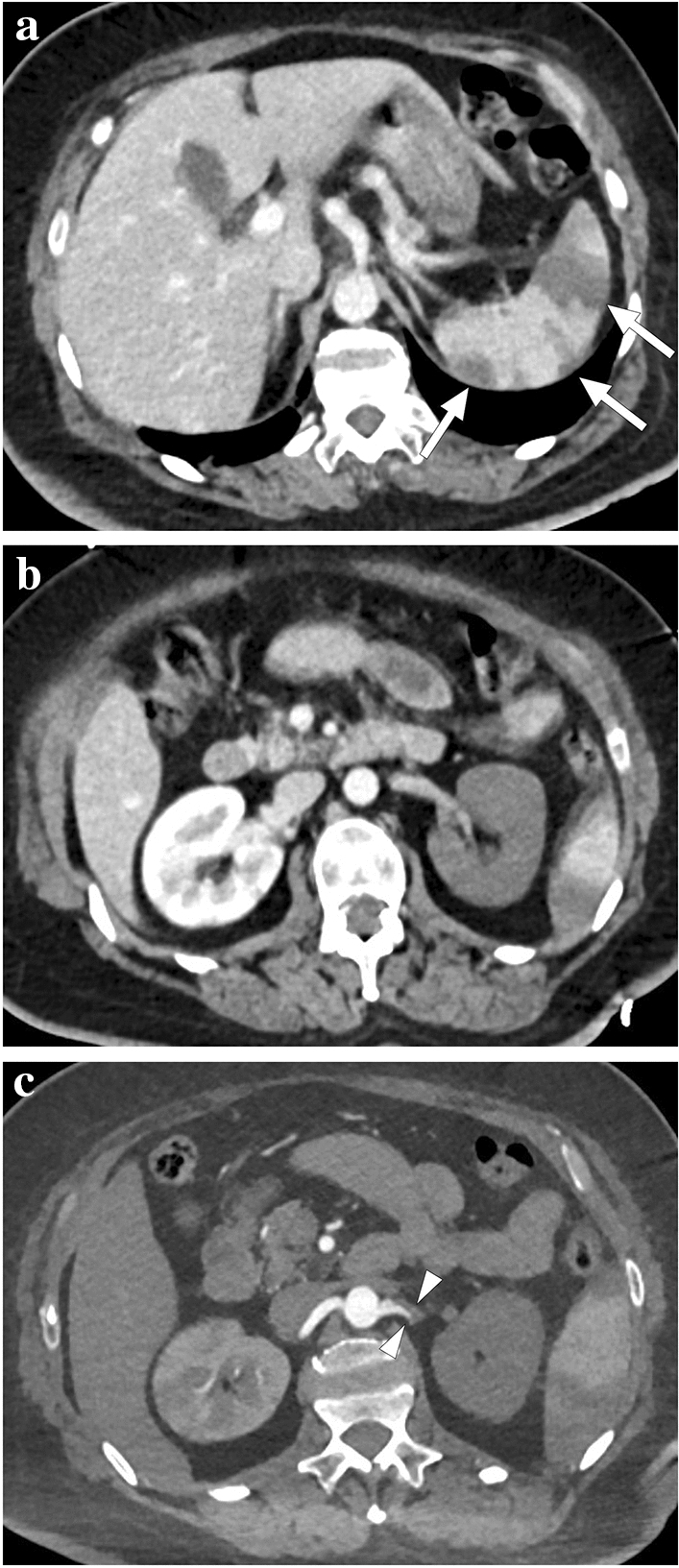 Fig. 40