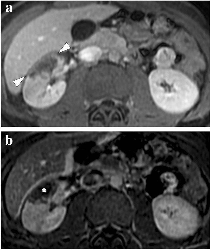 Fig. 16