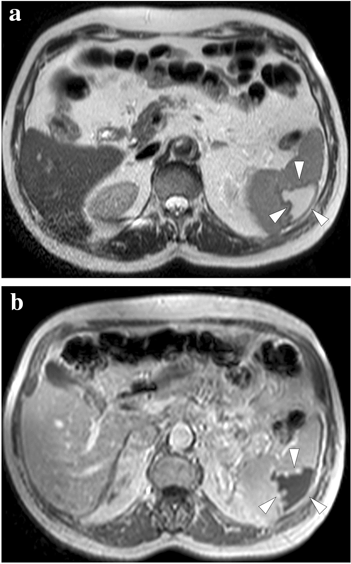 Fig. 20