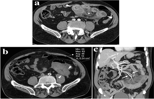 Fig. 14