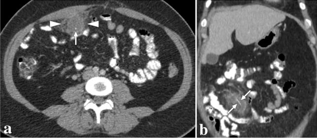 Fig. 29